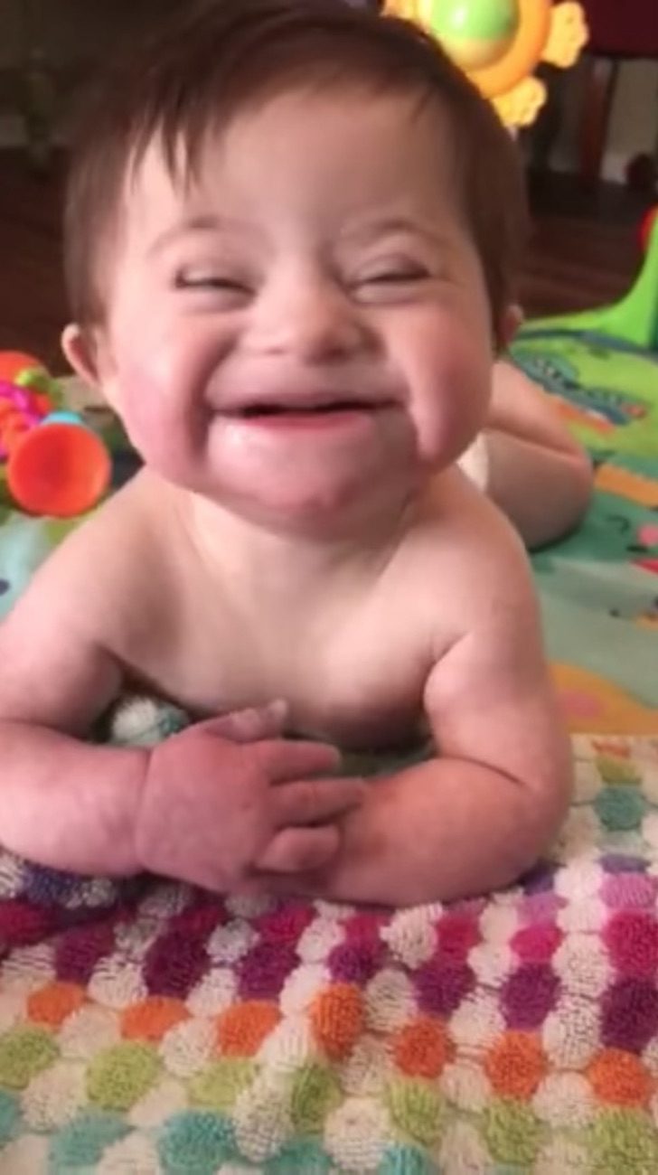 Bebé Con Síndrome De Down Es Adoptada Y Saluda A Su Nueva Madre Con Una Gran Sonrisa Via Ritmo 